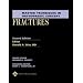 Master Techniques in Orthopaedic Surgery: Fractures