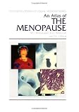 An Atlas of the Menopause (Encyclopedia of Visual Medicine) (Encyclopedia of Visual Medicine Series)
