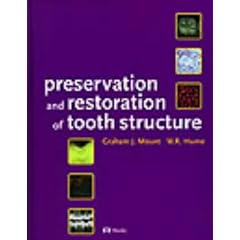 Preservation and Restoration of Tooth Structure
