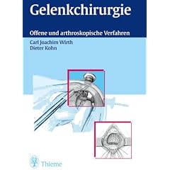 Gelenkchirurgie