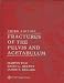 Fractures of the Pelvis and Acetabulum     **ISBN: 9780781732130**