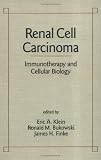 Renal Cell Carcinoma
