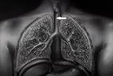 Historic Tuberculosis Films DVD: History of Pulmonary & Mycobacterium TB & Lung Disease Films