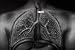 Historic Tuberculosis Films DVD: History of Pulmonary & Mycobacterium TB & Lung Disea...