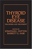 Thyroid Eye Disease: Diagnosis And Treatment