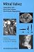 Mitral Valve: Floppy Mitral Valve, Mitral Valve Prolapse, Mitral Valvular Regurgitation