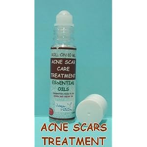 Acne Scar Treatment Organic Essential Oils Acne Scar Treatment - Organic Essential Oils