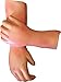 Herindera Appearance of Atopic Dermatitis RS.1500.00