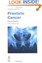 Challenges in Prostate Cancer