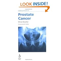 Challenges in Prostate Cancer