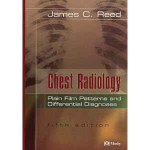 Chest Radiology -- Plain Film Patterns and Differential Diagnoses by James C. Reed