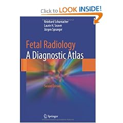 Fetal Radiology: A Diagnostic Atlas by Reinhard Schumacher, Laurie H. Seaver and Jürgen Spranger