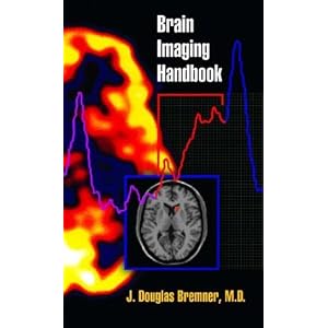 Click here to buy Brain Imaging Handbook by J. Douglas Bremner.