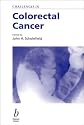 Challenges in Colorectal Cancer