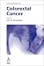 Challenges in Colorectal Cancer (Challenges in)