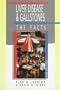 Liver Disease and Gallstones: The Facts (Oxford Medical Publications)