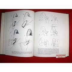 The Clubfoot by Wallace B. Lehman