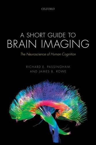 A Short Guide to Brain Imaging: The neuroscience of human cognition by Passingham Richard E. Rowe James B. (2015-12-01) Paperback