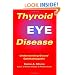 Thyroid Eye Disease: Understanding Graves\' Ophthalmopathy