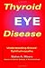 Thyroid Eye Disease: Understanding Graves\' Ophthalmopathy