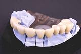 Dental Bridge - 24