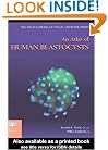 An Atlas of Human Blastocysts (Encyclopedia of Visual Medicine Series)