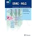 EMG. NLG: Elektromyographie, Nervenleitungsuntersuchungen