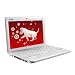 MSI Wind U100-279US 10-Inch Mini Laptop (1.6 GHz Intel Atom, 1 GB RAM, 160 GB Hard Drive, 6 Cell Battery, 802.11 b/g/n+BT, XP Home) White
