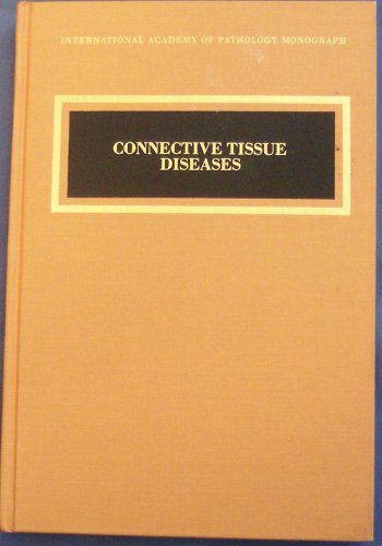 Connective-Tissue-Disorders
