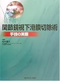 関節鏡視下滑膜切除術―手技の実際