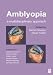 Amblyopia: A Multidisciplinary Approach