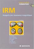 IRM : Imagerie par r�sonance magn�tique