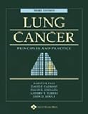 A Lung Cancer: Principles and Practice