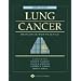 A Lung Cancer: Principles and Practice