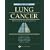 A Lung Cancer: Principles and Practice