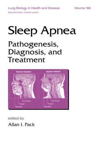 Sleep Disorders