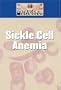 Sickle Cell Disease (Diseases & Disorders)
