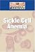Book Sickle Cell Disease (Diseases and Disorders)