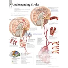 Understanding Stroke, Paper Chart (Taschenbuch)