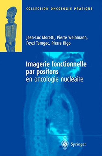 Download Imagerie fonctionnelles par positions en oncologie nucléaire Download Imagerie fonctionnelles par positions en oncologie nucléaire