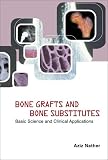 Bone Grafts and Bone Substitutes: Basic Science and Clinical Applications