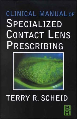 Contact-Lenses