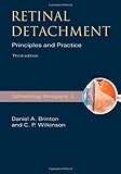 Retinal detachment : principles and practice