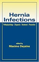 Hernia Infections: Pathophysiology - Diagnosis - Treatment - Prevention