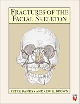 Fractures of the Facial Skeleton