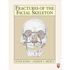 Fractures of the Facial Skeleton