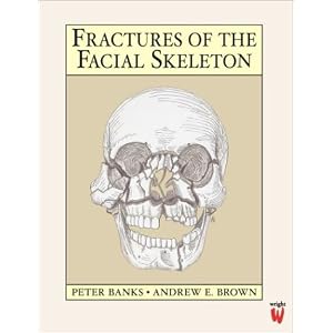 Click here to buy Fractures of the Facial Skeleton by Peter Banks FRCS(Edin) FDSRCS(Eng) FFDRCSI and Andrew Brown FRCS(Edin) FDSRCS(Eng) FDSRCPS(Glas).