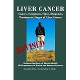 Liver Cancer: Causes, Symptoms, Signs, Diagnosis, Treatments, Stages of Liver Cancer - Revised Edition - Illustrated by S. Smith