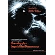 Echocardiography in Congenital Heart Disease Made Simple (Cardiopulmonary Medicine from Imperial... by  Siew Yen Ho, Michael L. Rigby, and Robert Henry Anderson