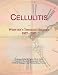 Cellulitis: Webster's Timeline History, 1857 - 2007